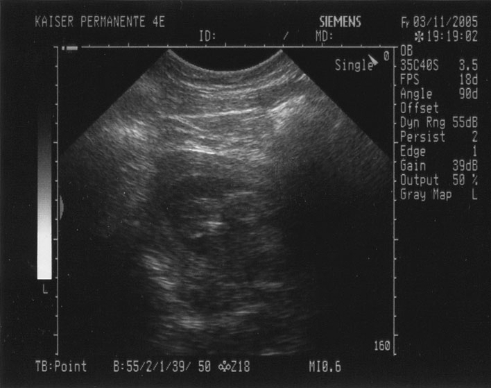 3/11/2005 Ultrasound